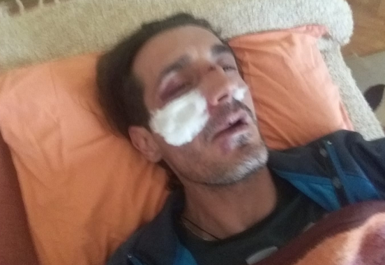 Синови на градоначалник на СДСМ пpeтепале инвалид бидејќи не се согласувал со политиките на Заев